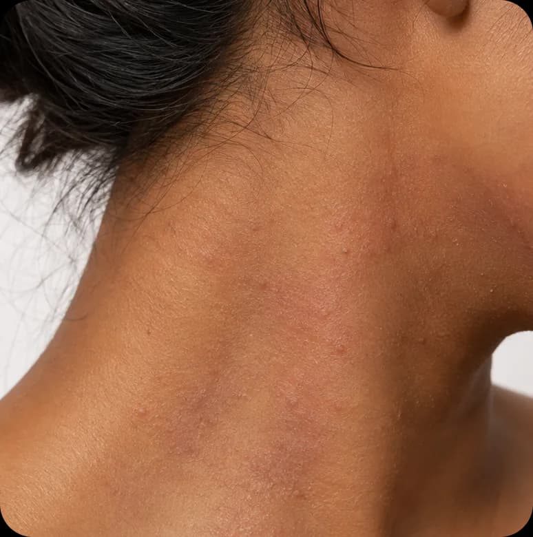 Side view of a neck and jaw showing uneven skin tone